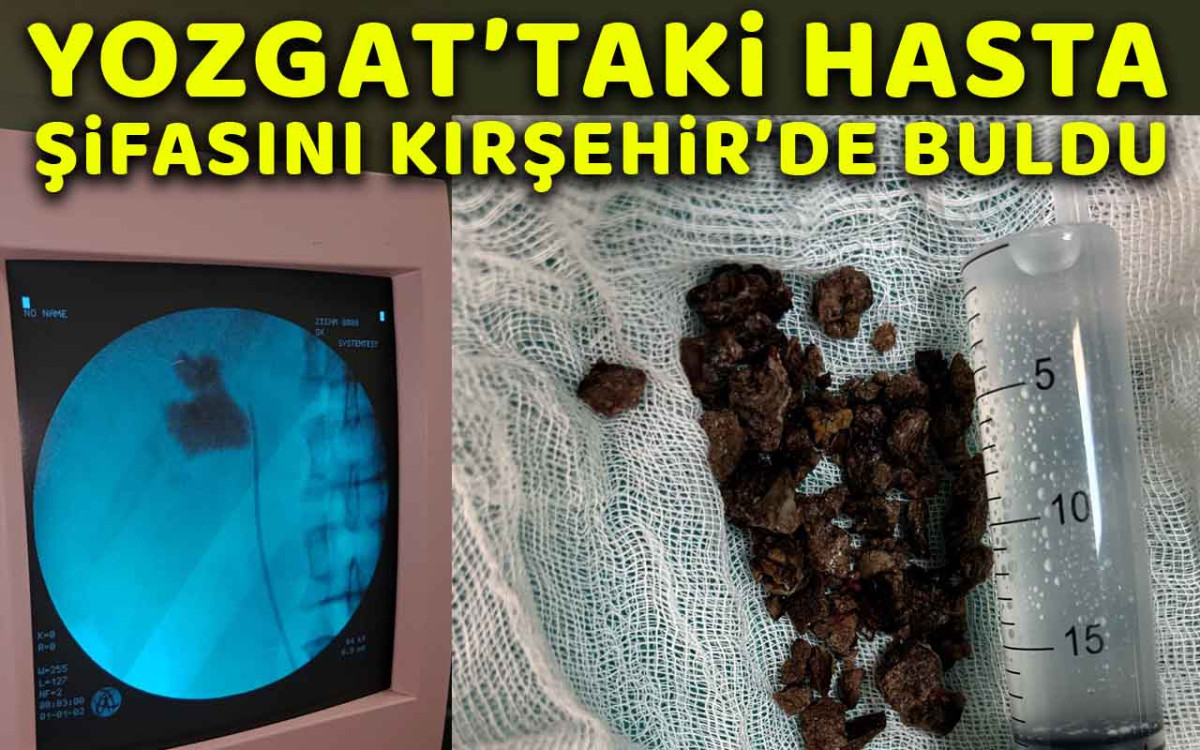 Yozgat'taki hasta şifasını Kırşehir'de buldu